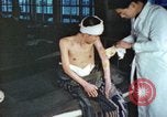Image of Japanese patient Nagasaki Japan, 1946, second 37 stock footage video 65675060752
