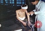 Image of Japanese patient Nagasaki Japan, 1946, second 38 stock footage video 65675060752