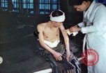 Image of Japanese patient Nagasaki Japan, 1946, second 39 stock footage video 65675060752