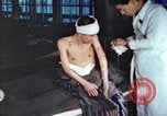 Image of Japanese patient Nagasaki Japan, 1946, second 40 stock footage video 65675060752