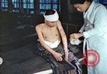 Image of Japanese patient Nagasaki Japan, 1946, second 41 stock footage video 65675060752