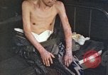 Image of Japanese patient Nagasaki Japan, 1946, second 48 stock footage video 65675060752