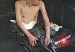 Image of Japanese patient Nagasaki Japan, 1946, second 49 stock footage video 65675060752
