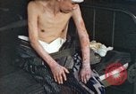 Image of Japanese patient Nagasaki Japan, 1946, second 53 stock footage video 65675060752