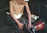 Image of Japanese patient Nagasaki Japan, 1946, second 55 stock footage video 65675060752