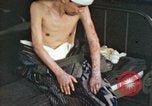 Image of Japanese patient Nagasaki Japan, 1946, second 57 stock footage video 65675060752