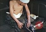 Image of Japanese patient Nagasaki Japan, 1946, second 58 stock footage video 65675060752