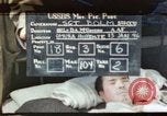 Image of Japanese patient Nagasaki Japan, 1946, second 1 stock footage video 65675060753