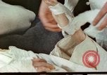 Image of Japanese patient Nagasaki Japan, 1946, second 3 stock footage video 65675060753