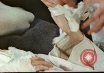 Image of Japanese patient Nagasaki Japan, 1946, second 4 stock footage video 65675060753