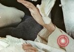 Image of Japanese patient Nagasaki Japan, 1946, second 6 stock footage video 65675060753