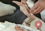 Image of Japanese patient Nagasaki Japan, 1946, second 9 stock footage video 65675060753