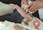 Image of Japanese patient Nagasaki Japan, 1946, second 11 stock footage video 65675060753
