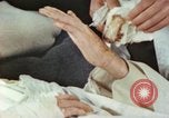 Image of Japanese patient Nagasaki Japan, 1946, second 13 stock footage video 65675060753