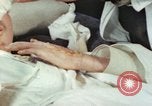 Image of Japanese patient Nagasaki Japan, 1946, second 18 stock footage video 65675060753