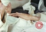 Image of Japanese patient Nagasaki Japan, 1946, second 20 stock footage video 65675060753