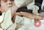 Image of Japanese patient Nagasaki Japan, 1946, second 21 stock footage video 65675060753