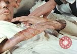 Image of Japanese patient Nagasaki Japan, 1946, second 27 stock footage video 65675060753