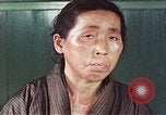 Image of Japanese patient Nagasaki Japan, 1946, second 41 stock footage video 65675060754