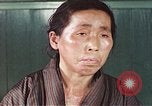 Image of Japanese patient Nagasaki Japan, 1946, second 42 stock footage video 65675060754