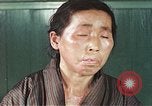 Image of Japanese patient Nagasaki Japan, 1946, second 43 stock footage video 65675060754