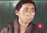 Image of Japanese patient Nagasaki Japan, 1946, second 45 stock footage video 65675060754