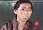 Image of Japanese patient Nagasaki Japan, 1946, second 50 stock footage video 65675060754
