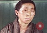 Image of Japanese patient Nagasaki Japan, 1946, second 51 stock footage video 65675060754