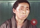 Image of Japanese patient Nagasaki Japan, 1946, second 53 stock footage video 65675060754