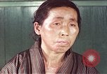Image of Japanese patient Nagasaki Japan, 1946, second 55 stock footage video 65675060754