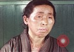 Image of Japanese patient Nagasaki Japan, 1946, second 56 stock footage video 65675060754