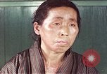 Image of Japanese patient Nagasaki Japan, 1946, second 57 stock footage video 65675060754