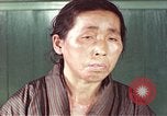 Image of Japanese patient Nagasaki Japan, 1946, second 59 stock footage video 65675060754