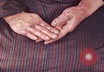 Image of Japanese patient Nagasaki Japan, 1946, second 60 stock footage video 65675060754