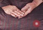 Image of Japanese patient Nagasaki Japan, 1946, second 61 stock footage video 65675060754