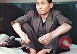 Standbild männlicher Patient Nagasaki Japan, 1946, aus Sekunde 3 historischem Filmmaterial Videoclip 65675060757