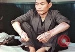 Standbild männlicher Patient Nagasaki Japan, 1946, aus Sekunde 5 historischem Filmmaterial Videoclip 65675060757