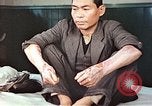 Standbild männlicher Patient Nagasaki Japan, 1946, aus Sekunde 7 historischem Filmmaterial Videoclip 65675060757