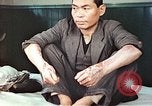 Standbild männlicher Patient Nagasaki Japan, 1946, aus Sekunde 9 historischem Filmmaterial Videoclip 65675060757