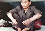 Standbild männlicher Patient Nagasaki Japan, 1946, aus Sekunde 10 historischem Filmmaterial Videoclip 65675060757