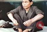 Standbild männlicher Patient Nagasaki Japan, 1946, aus Sekunde 12 historischem Filmmaterial Videoclip 65675060757