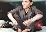 Standbild männlicher Patient Nagasaki Japan, 1946, aus Sekunde 15 historischem Filmmaterial Videoclip 65675060757