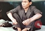 Standbild männlicher Patient Nagasaki Japan, 1946, aus Sekunde 18 historischem Filmmaterial Videoclip 65675060757