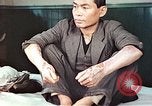 Standbild männlicher Patient Nagasaki Japan, 1946, aus Sekunde 21 historischem Filmmaterial Videoclip 65675060757