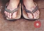 Standbild männlicher Patient Nagasaki Japan, 1946, aus Sekunde 43 historischem Filmmaterial Videoclip 65675060757