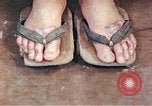 Standbild männlicher Patient Nagasaki Japan, 1946, aus Sekunde 46 historischem Filmmaterial Videoclip 65675060757