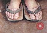 Standbild männlicher Patient Nagasaki Japan, 1946, aus Sekunde 47 historischem Filmmaterial Videoclip 65675060757