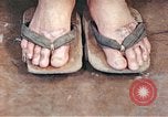 Standbild männlicher Patient Nagasaki Japan, 1946, aus Sekunde 48 historischem Filmmaterial Videoclip 65675060757