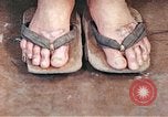 Standbild männlicher Patient Nagasaki Japan, 1946, aus Sekunde 50 historischem Filmmaterial Videoclip 65675060757