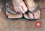 Standbild männlicher Patient Nagasaki Japan, 1946, aus Sekunde 53 historischem Filmmaterial Videoclip 65675060757